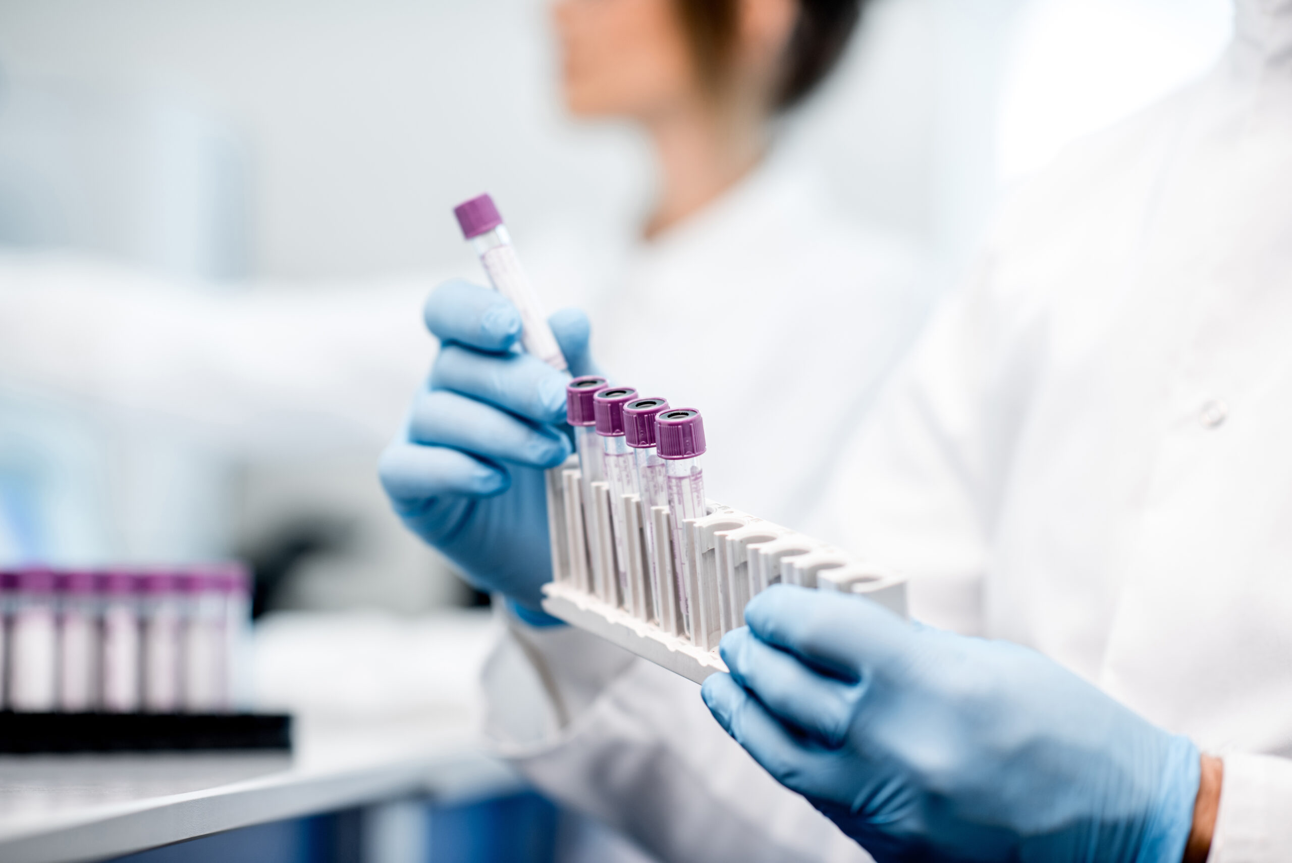 A person wearing a lab coat and blue latex gloves is holding a set of test tubes