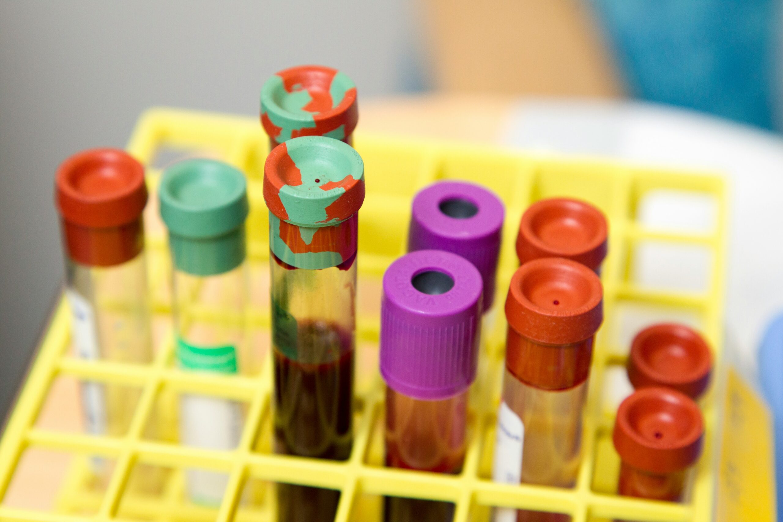 A collection of test tubes sat in a yellow holding tray.