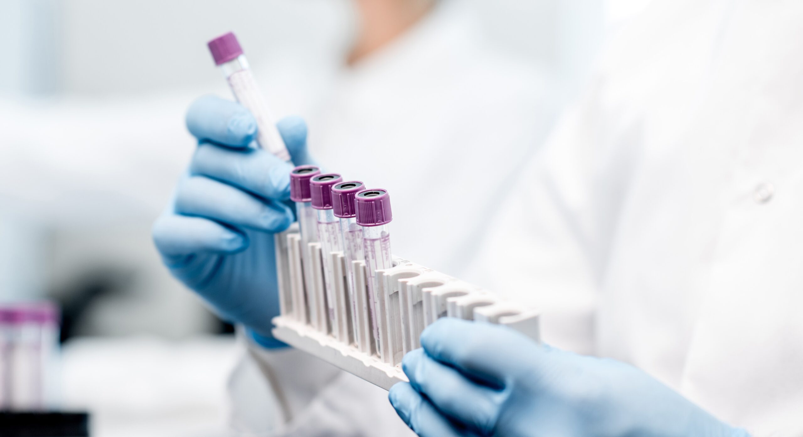A person wearing a lab coat and blue gloves is holding a set of test tubes