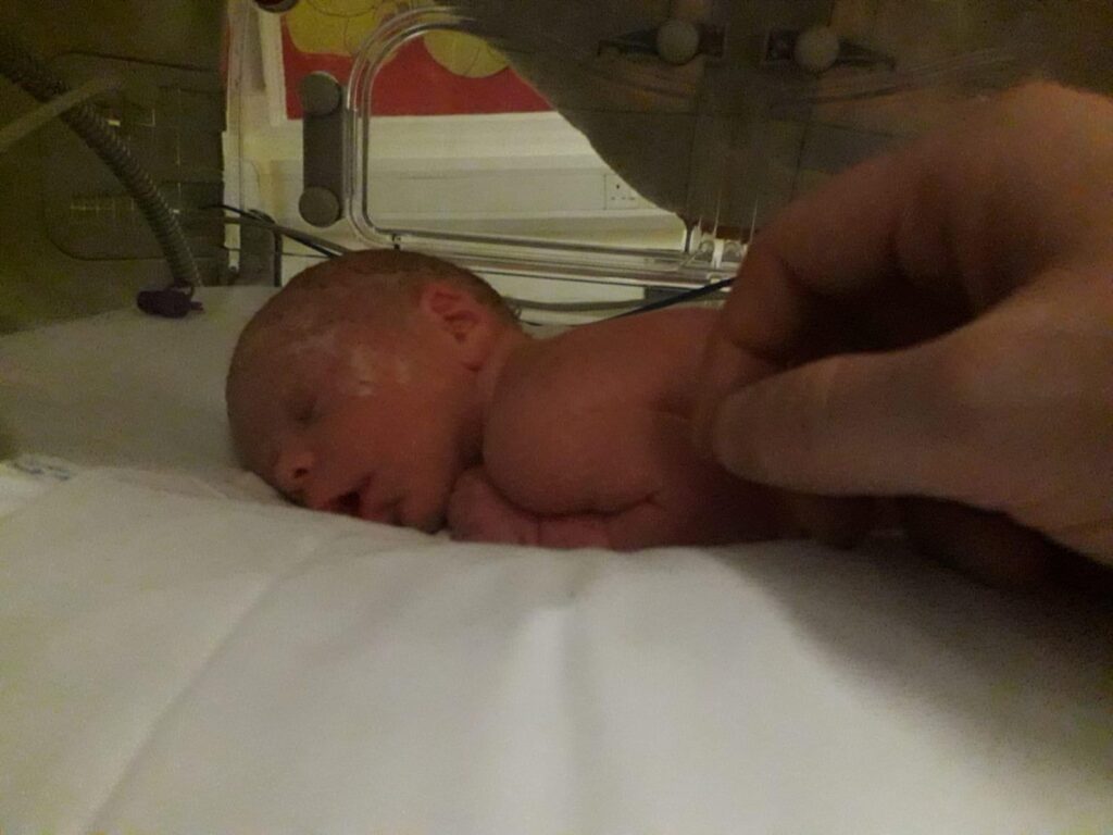 A tiny baby lies in a hospital cot in an intensive care unit. 