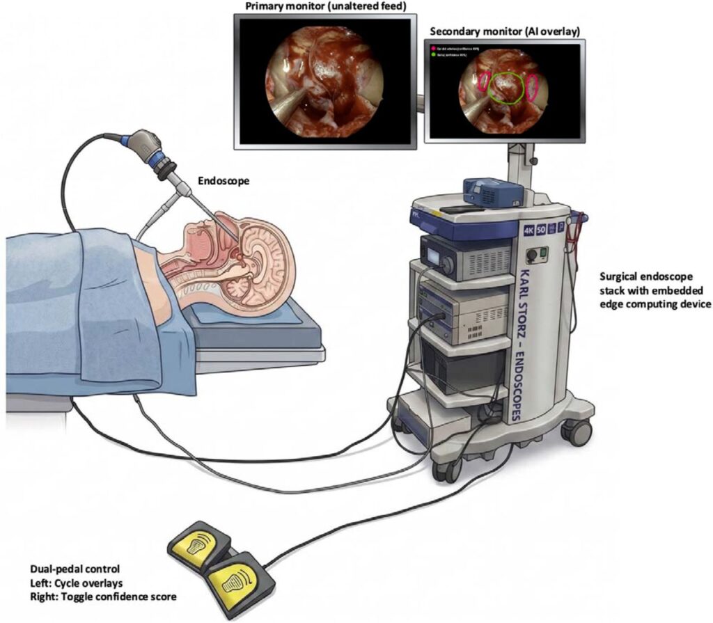 An illustration showing a patient undergoing pituitary surgery. An endoscope is passed through their nose and feeds into a computer monitor next to the patient.
